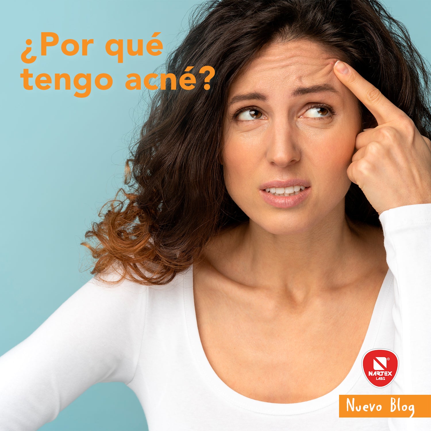 ¿Por qué tengo acné?